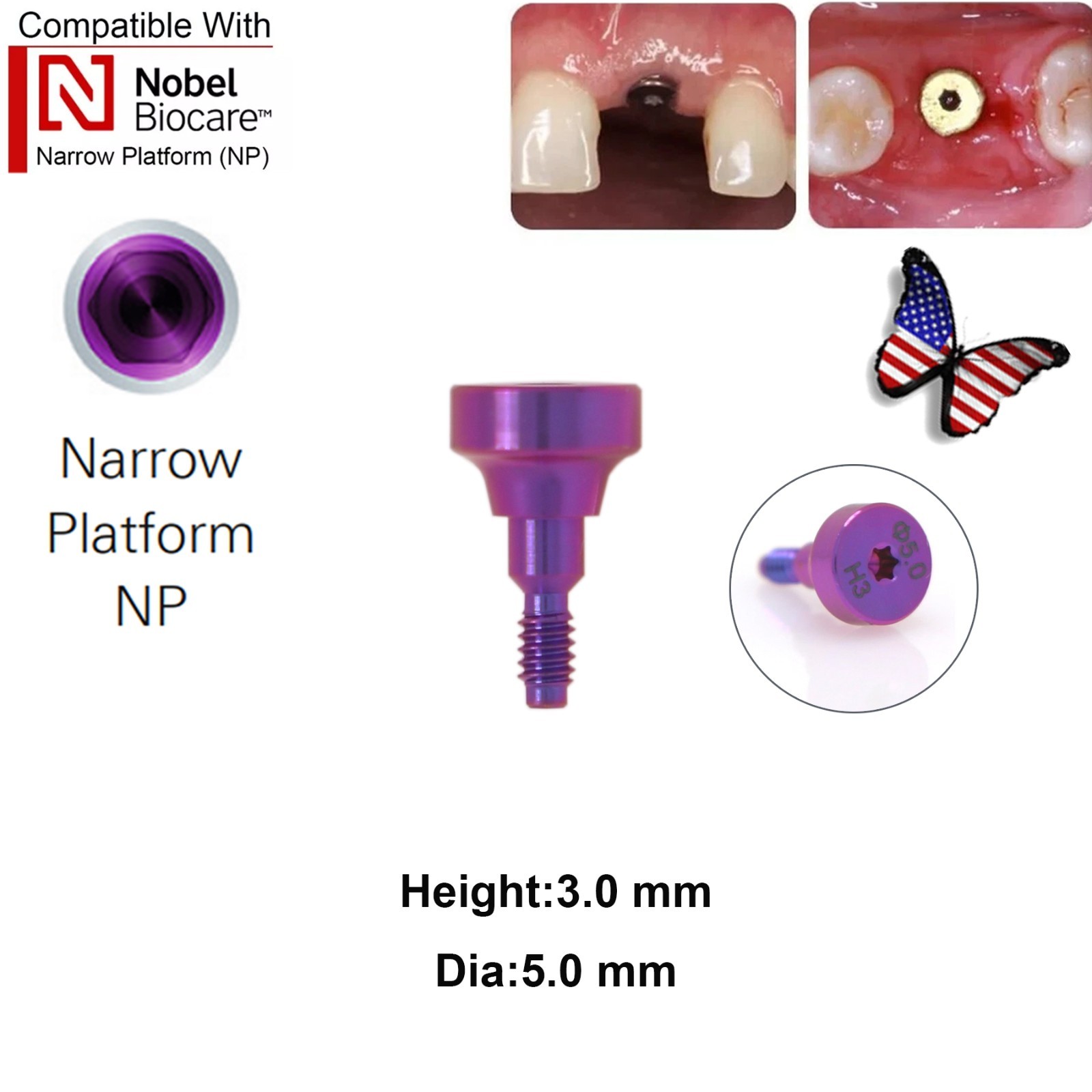 5Pcs Nobel active Healing Abutment Cover Screw Healing Screw Gum Molding Implant