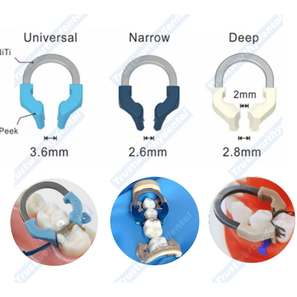 Dental Sectional Matrix Ring Matrice Bands Clamp Ring Fit Garrison Palodent V3