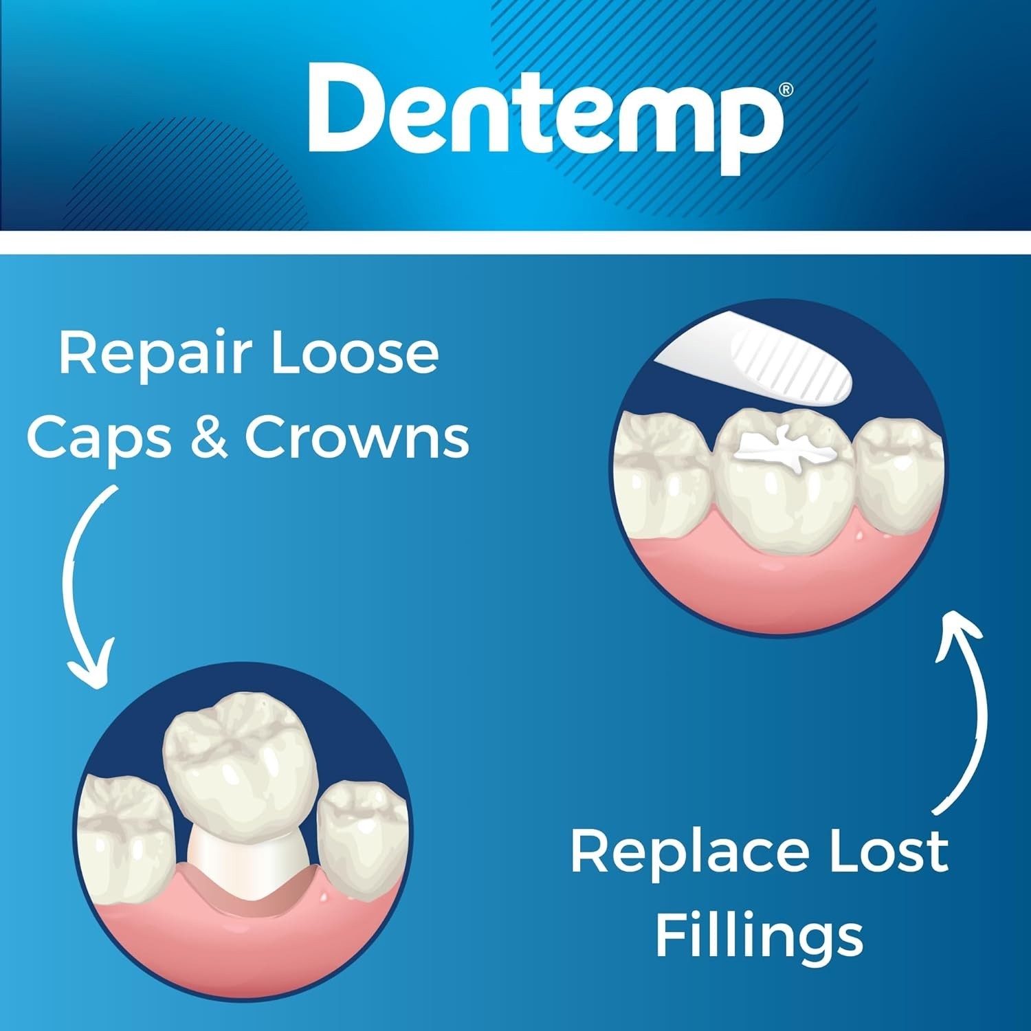 Ultimate Dental Repair Kit: Maximum Strength Loose Cap & Filling Repair – 3 Pack