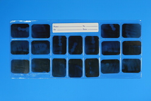Dental Full Mouth Mount (FMX) X-Ray Film Mounts CP12H6V