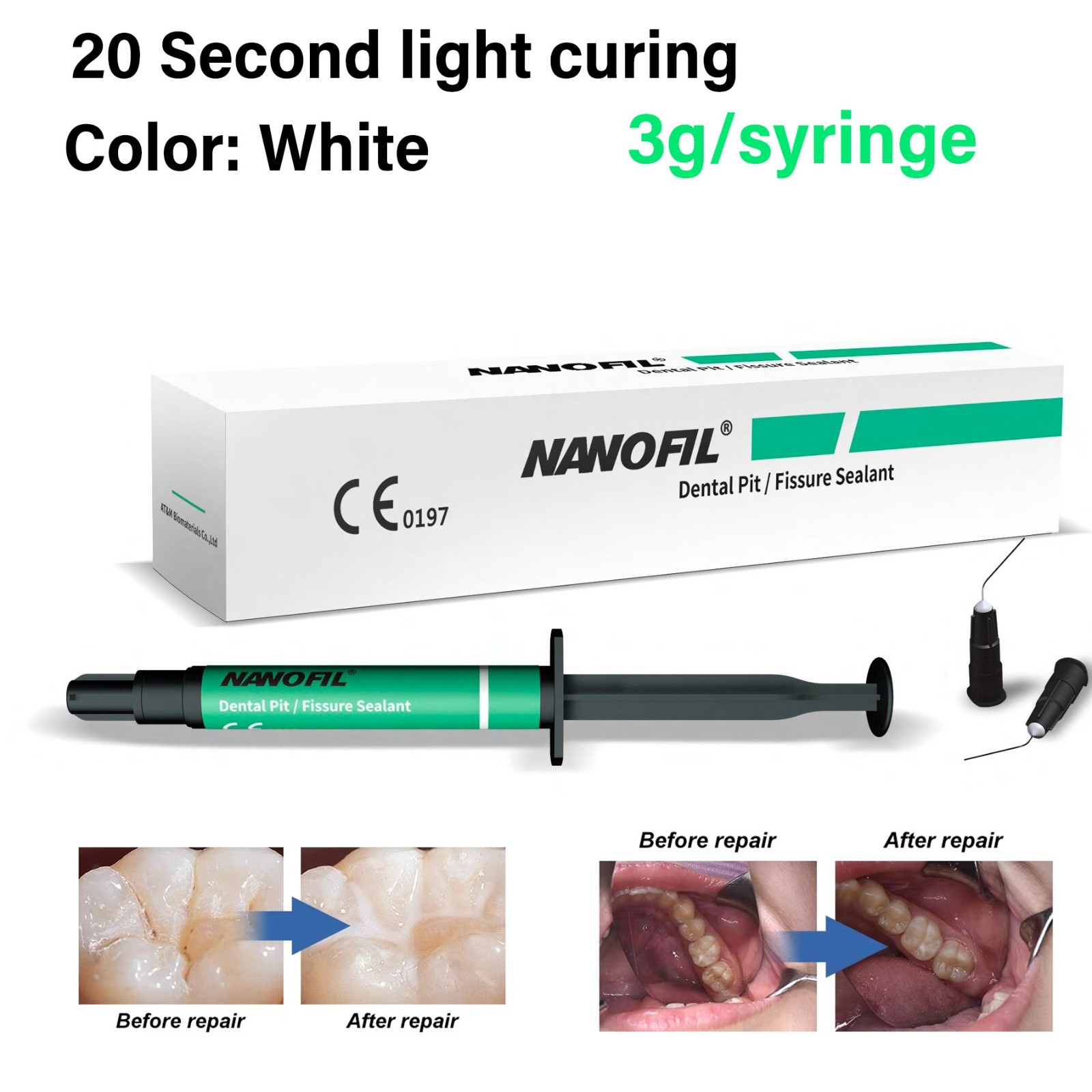 Dental Pit and Fissure Sealant Light Cure Effective Cavity Protection Prevents
