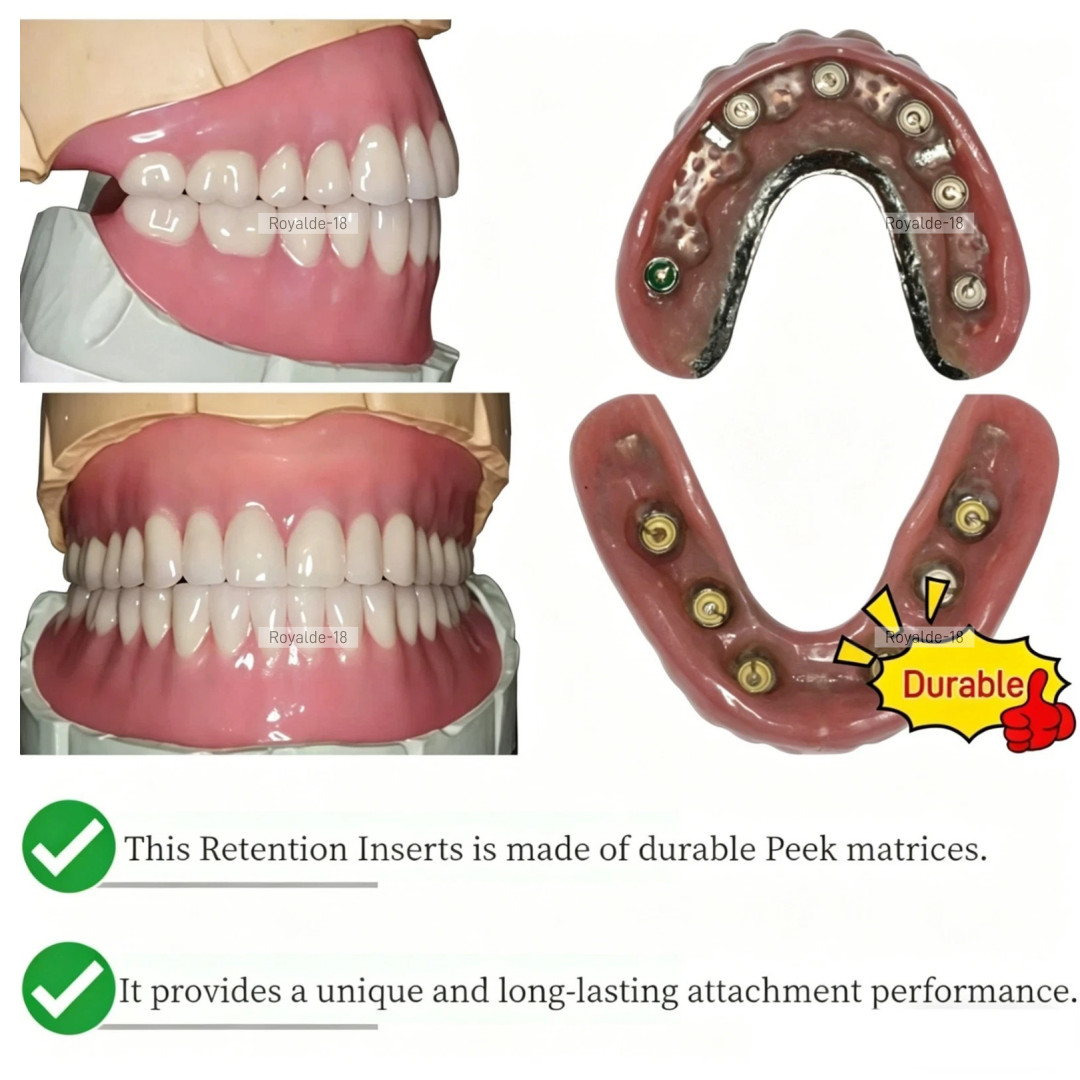 PEEK Cap Retention Insert Caps Novaloc Type Abutment ITI Titanium Housing RC/NC