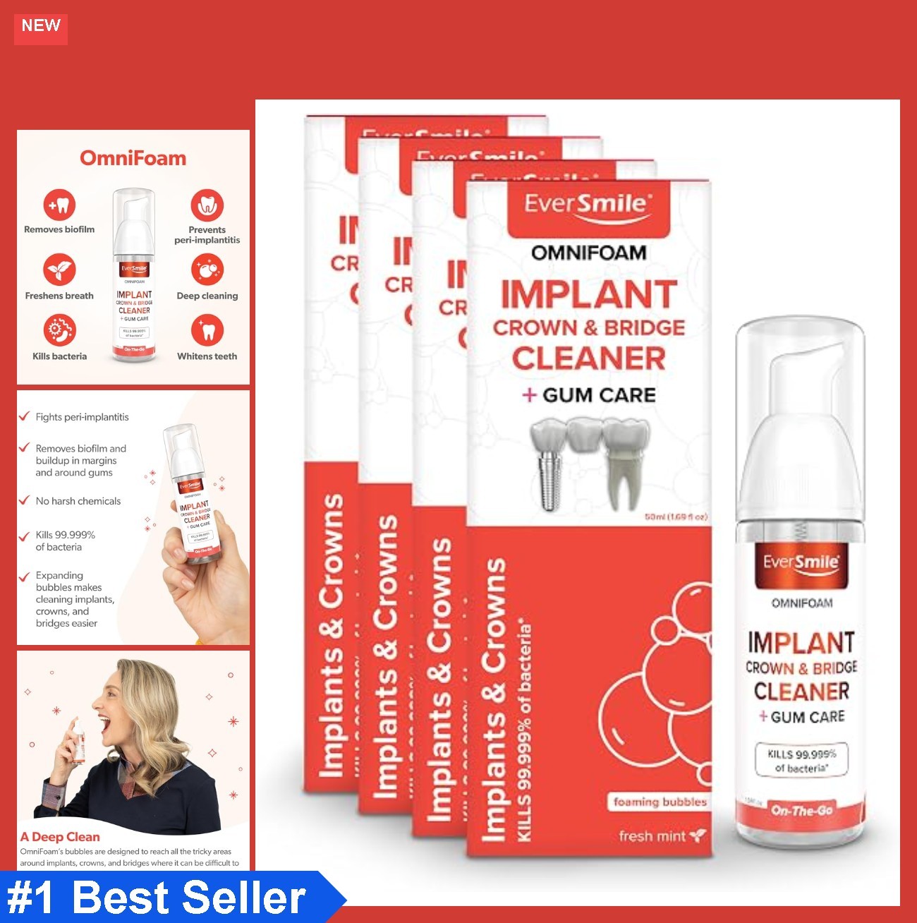 Dental Cleaning Foam for Implants Crowns Bridges Pack of 4 50ml Mint Fresh