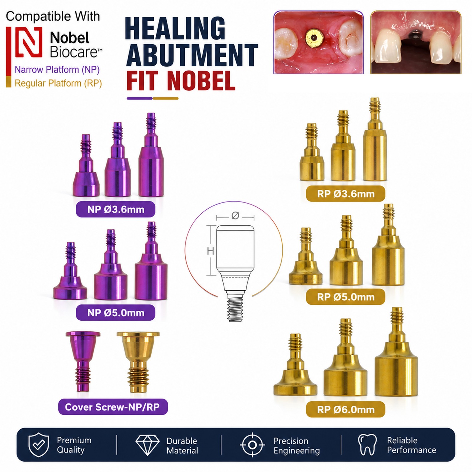 US Nobel Biocare Implant Healing Abutment Cap Titanium NP RP CC Temporary Dental