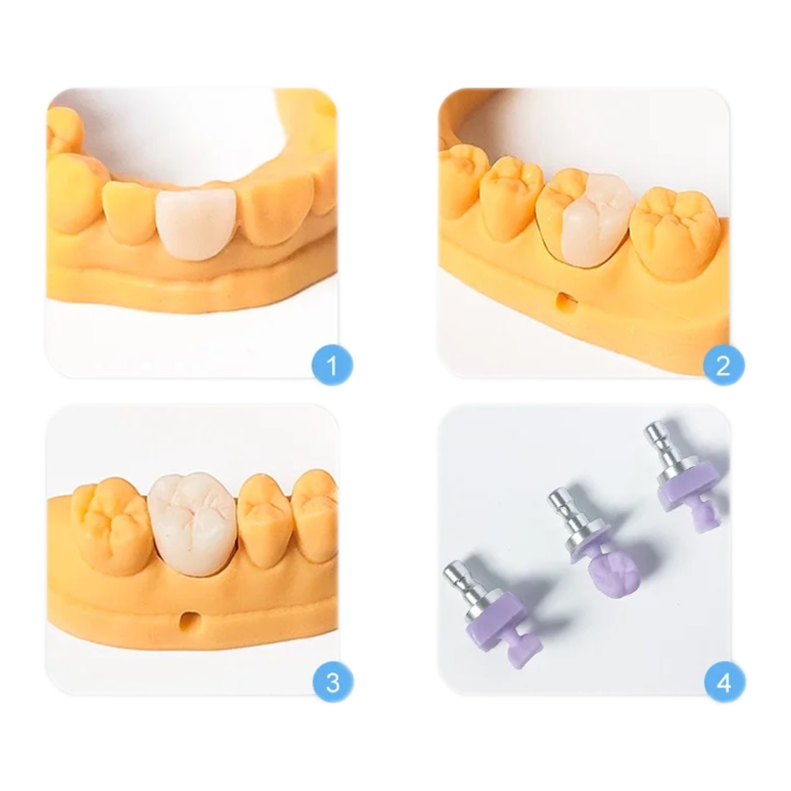 US Emax Dental Lithium Disilicate Glass Ceramics CEREC HT CAD/CAM Milling Blocks