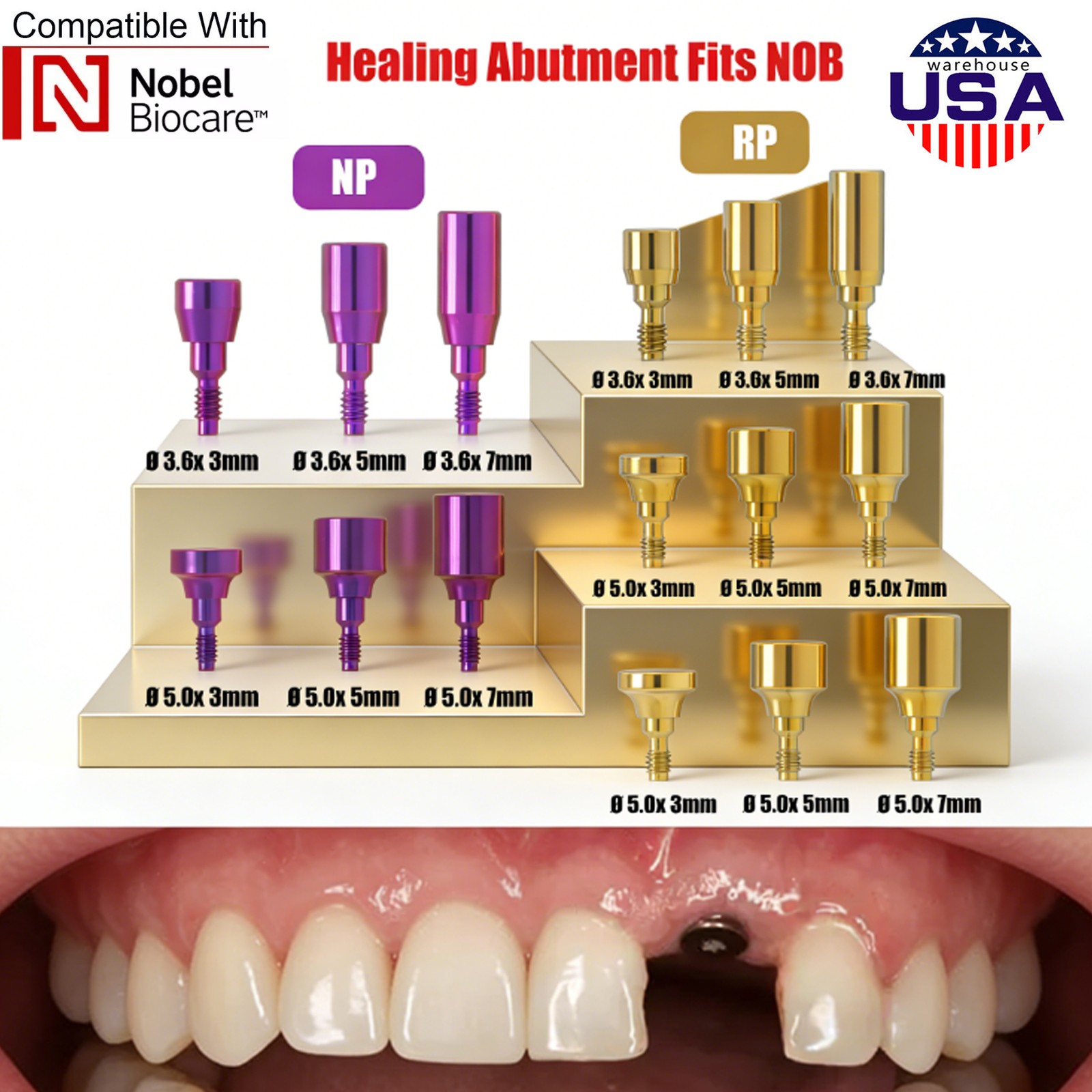 US Nobel Biocare Implant Healing Abutment Cap Titanium NP RP CC Temporary Dental