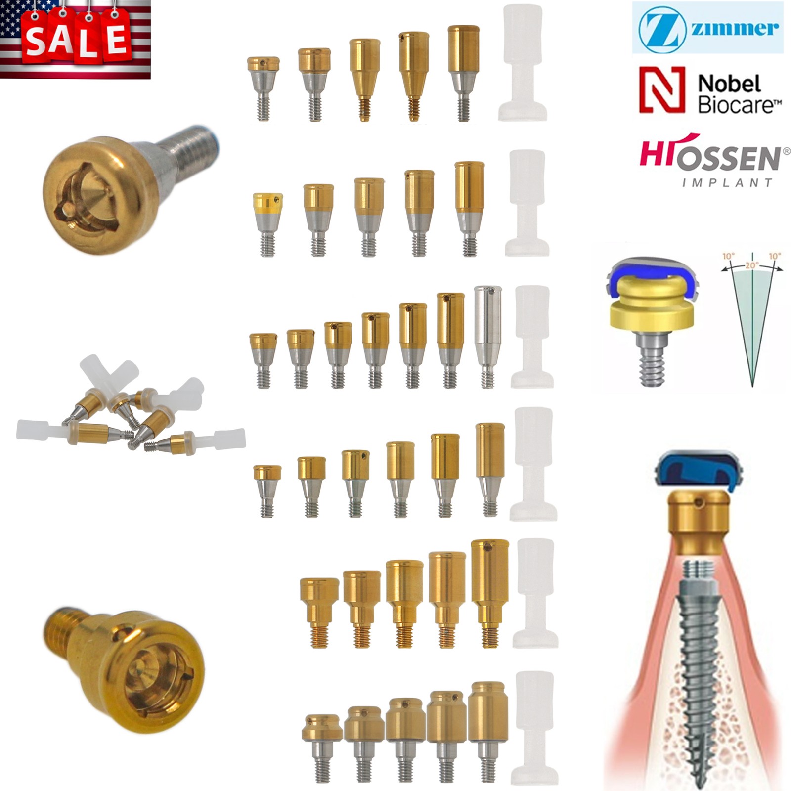 Locator Abutment Overdenture Implant Retention Caps Inserts Zimmer/Nobel/Hiossen