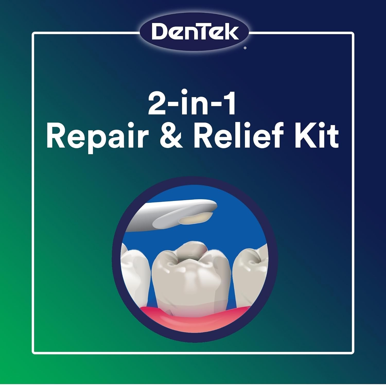 Temparin Max Dental Repair Kit – 13+ Repairs, Secure Protection in 48 Hours