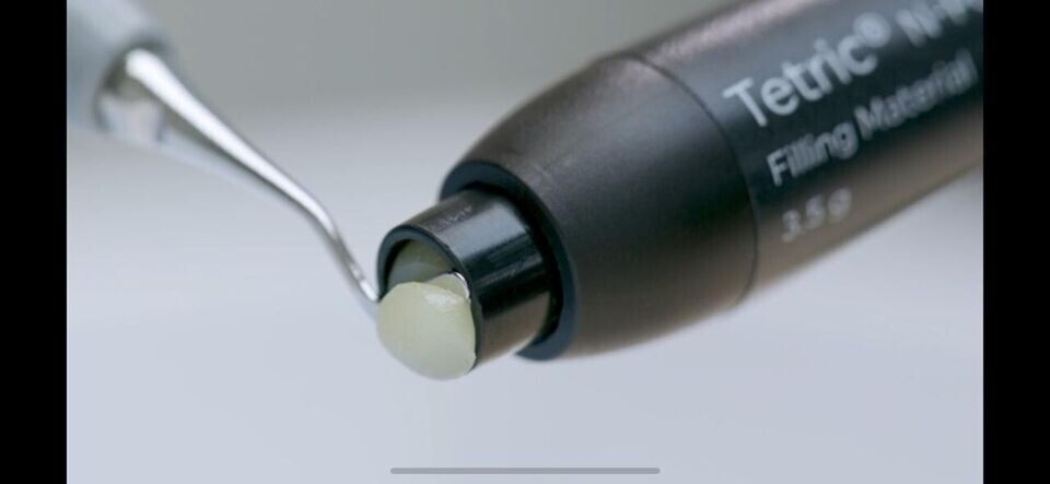 Ivoclar Vivadent Tetric N Ceram 2 Polymer Based Dental Restorative Material Kit