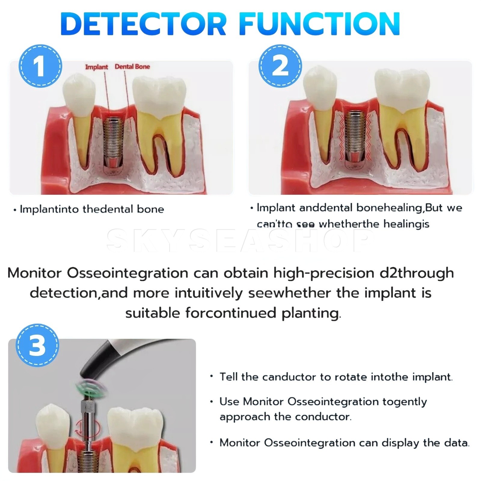 Dental Implant Stability Measurement Instrument | Free Fast ship