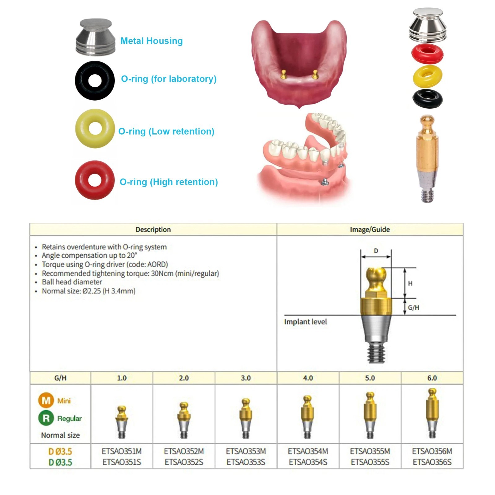 US Dental Hiossen/Osstem Fit Ball Abutment O-Ring Retention Kit Overdenture Caps