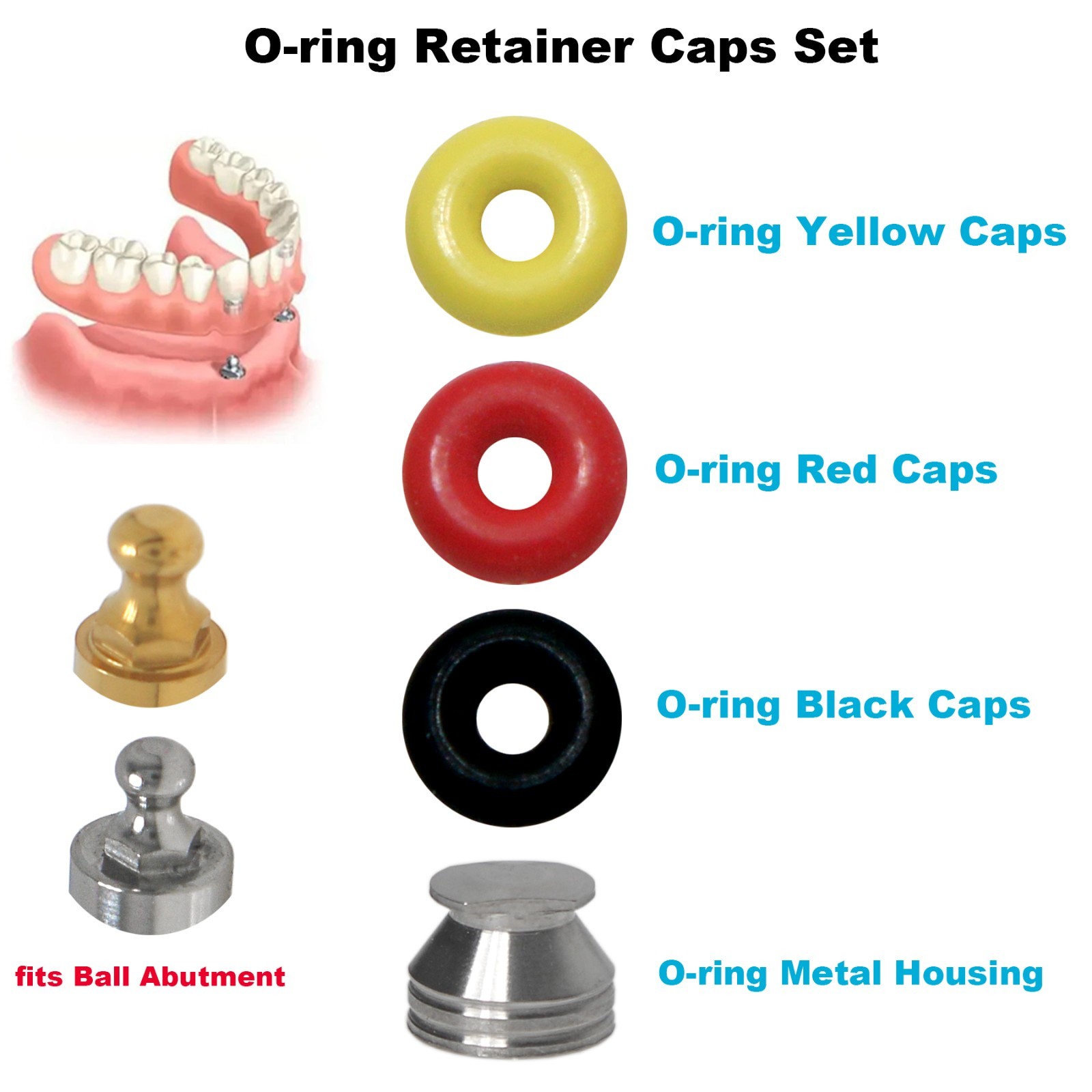 Implant O-Ring Retention Kit Dental Ball Abutment Compatible with Hiossen Osstem