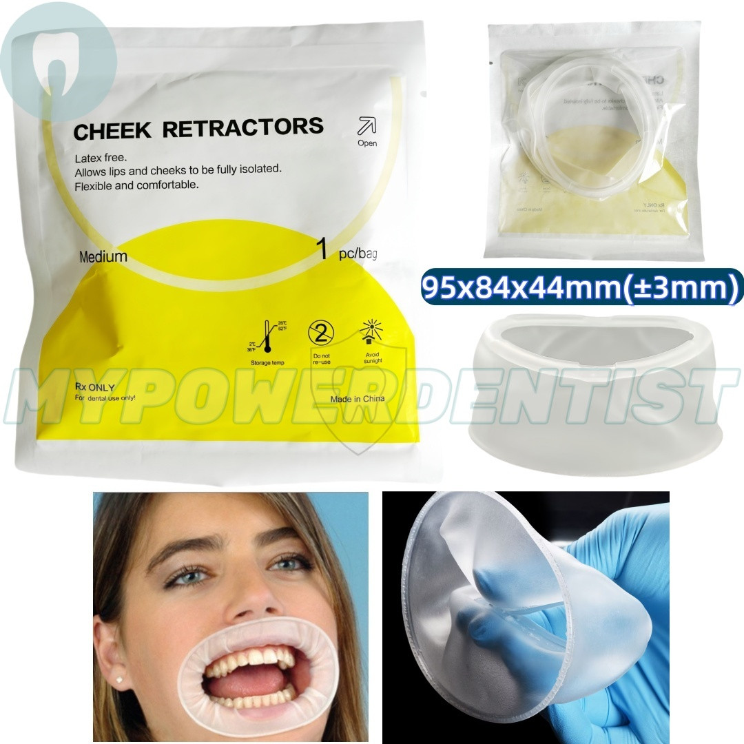 Dental O Shape Mouth Opener Lip Cheek Retractors Intraoral Lip Expander Opener