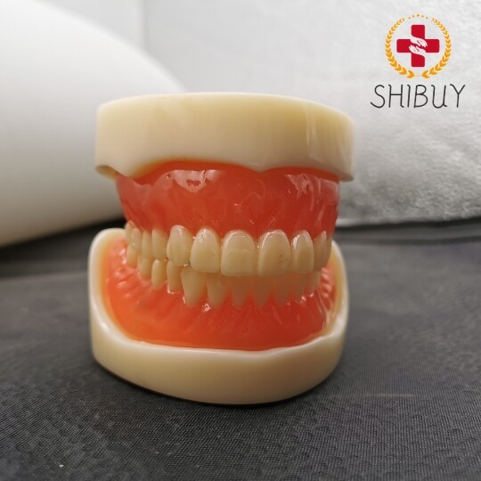 Dental 4 Implants Overdenture Typodont Restoration Upper Lower Lower Teeth Model