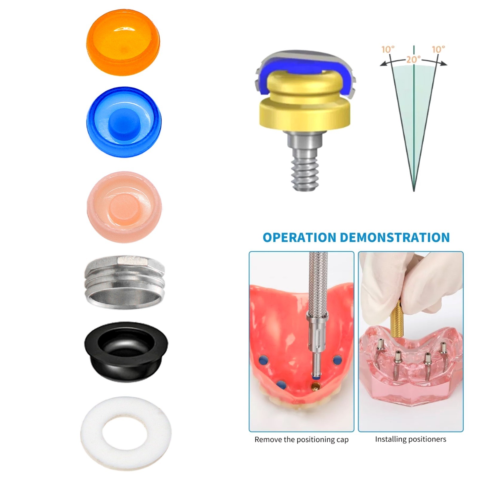 US Dental Overdenture Locator Abutments Retention Caps Implant Inserts 5Pcs/Set