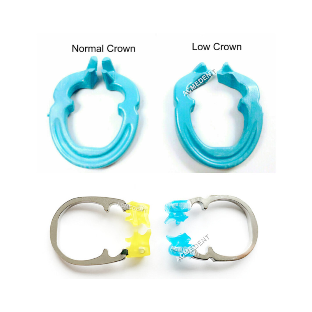 4Types Dental Matrix Ring Matrices Clamp Rings Clip Matrice Band Soft Resin Blue