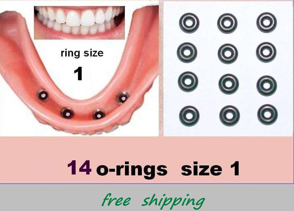 12 + 2* rubber O-RINGS size 1 – for mini dental implants comp. 0550 a.m.o.