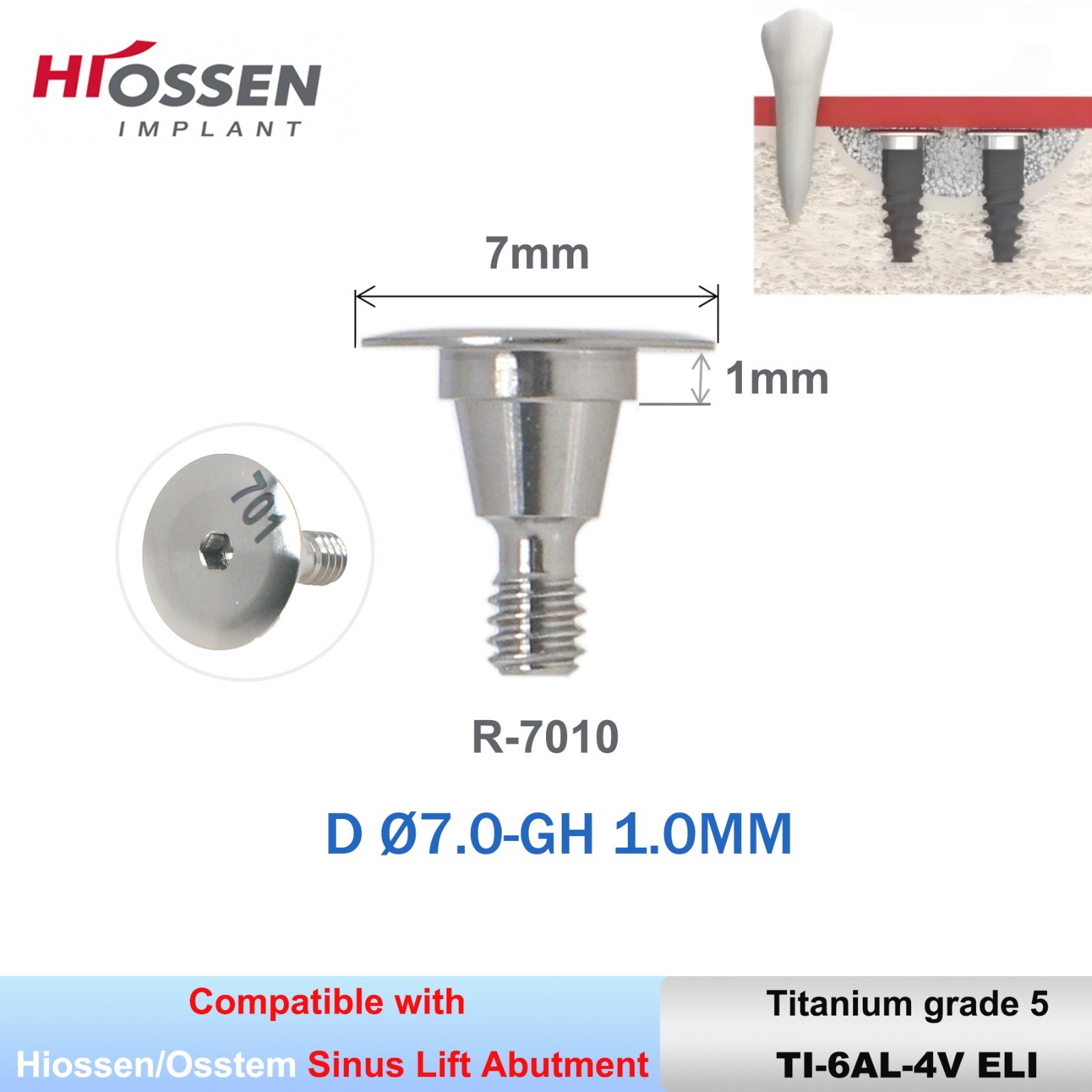 Sinus Lift Temporary Abutments Ti Superline fit Hiossen/DIO UFI/II R/CSM ITI RN