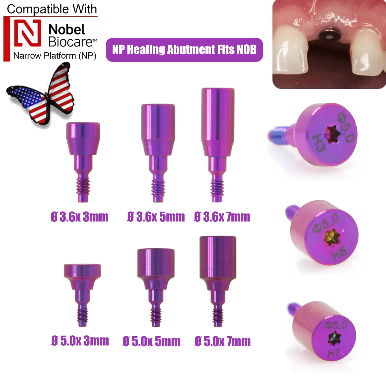US Nobel Biocare Active NP/RP Hex Locator/Healing Abutment/ Impression Transfer