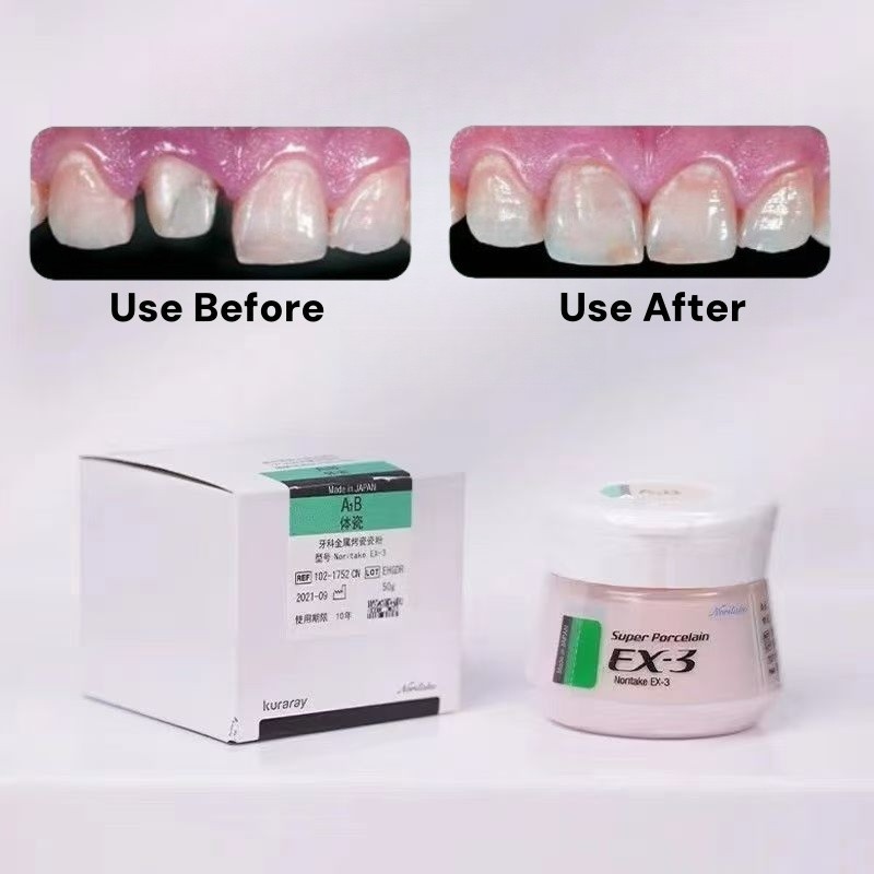 Noritake EX-3 Super Porcelain Powder Body For Metal Ceramic Dental Restorations