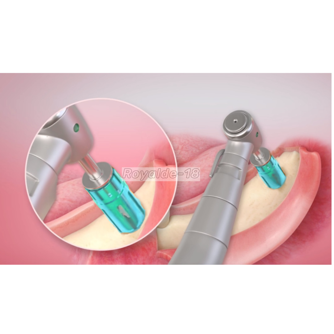 Dental Autobone Chip Autologous bone harvesting drill Never Loss Harvest Implant