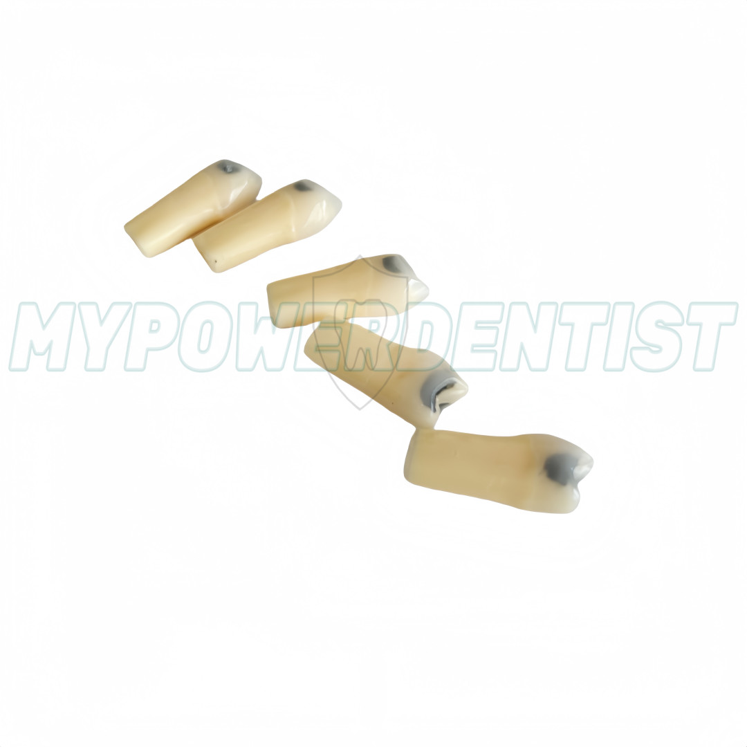 25# Dental Cavity Teeth Model Tooth Teaching Caries ModelCompatible Frasaco AG-3