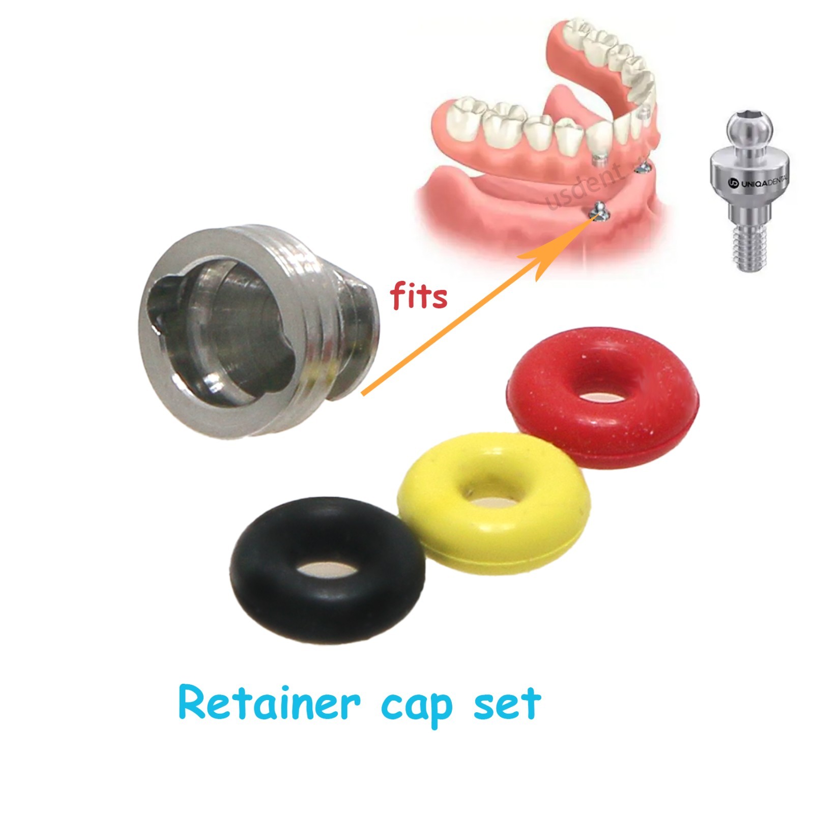 Dental O-Ring Retention Cap Ball Attachment Fit Hiossen Osstem Implant 4Pcs/Set