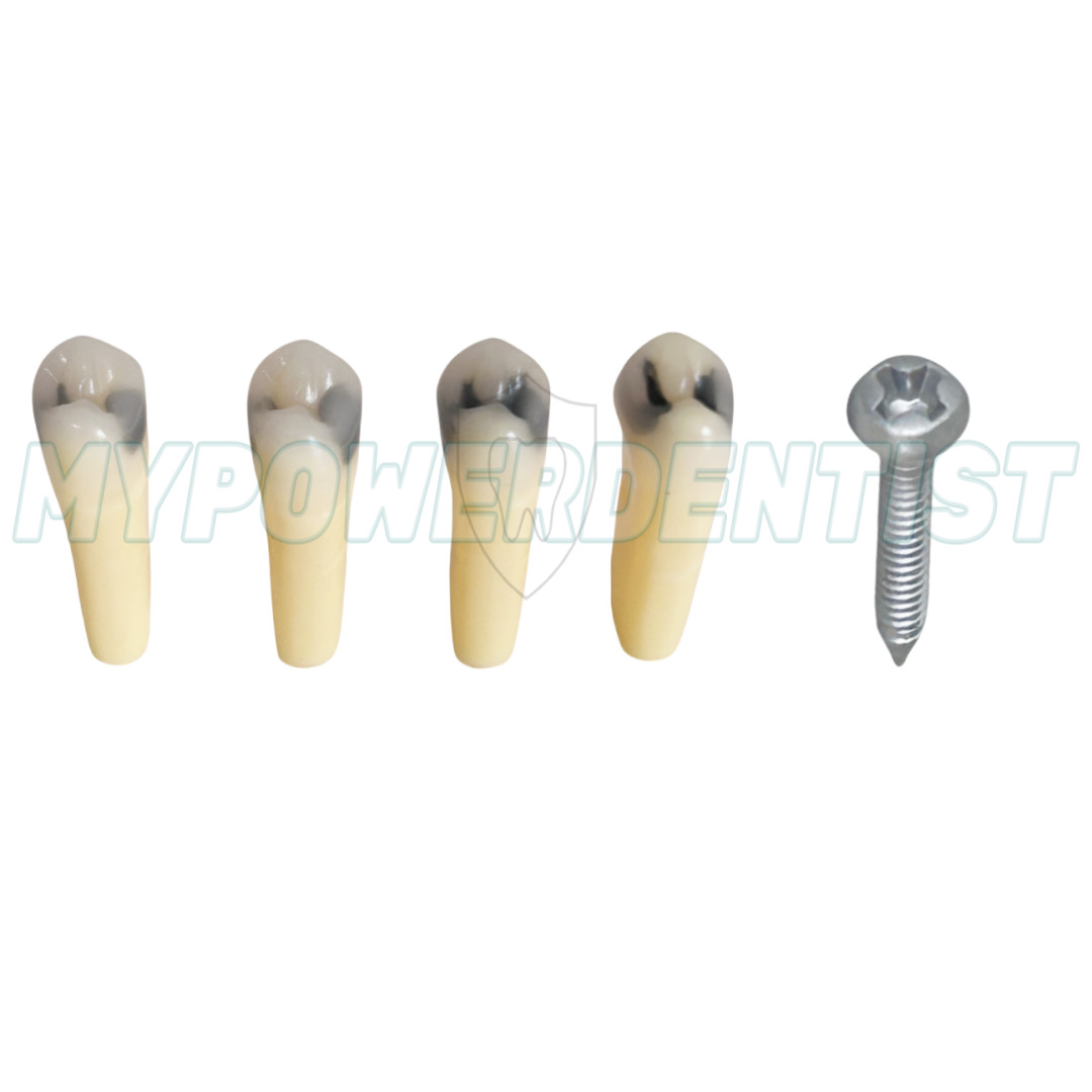 25# Dental Cavity Teeth Model Tooth Teaching Caries ModelCompatible Frasaco AG-3