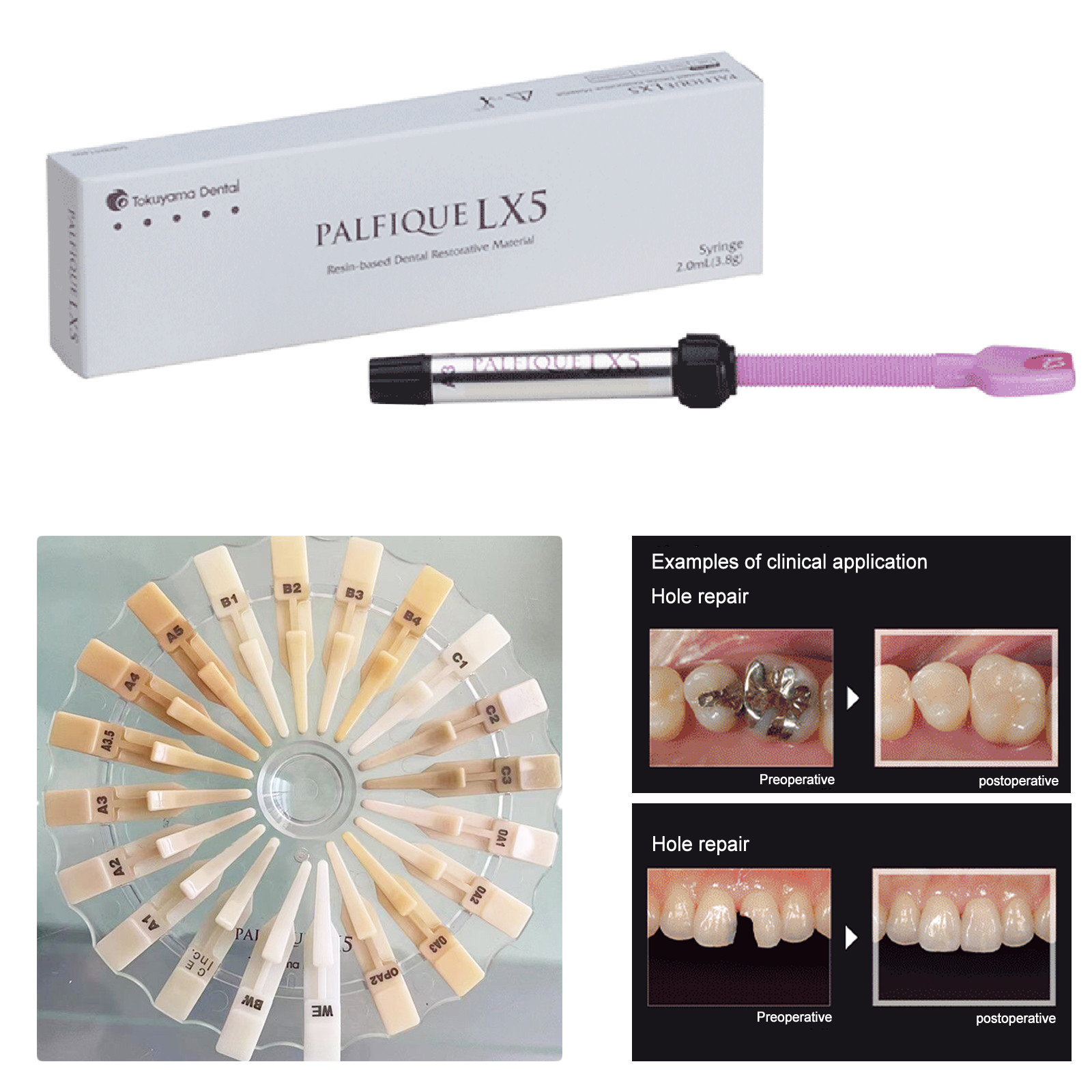 100% Palfique Tokuyama LX5-BW Resin Based Dental Restorative Composite 3.8gm.