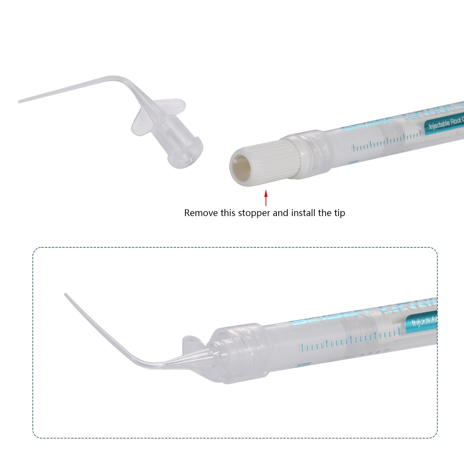 1g nRoot SP Injectable Root Canal Bioceramic Sealer 1g Syringe + 10Tips Dental
