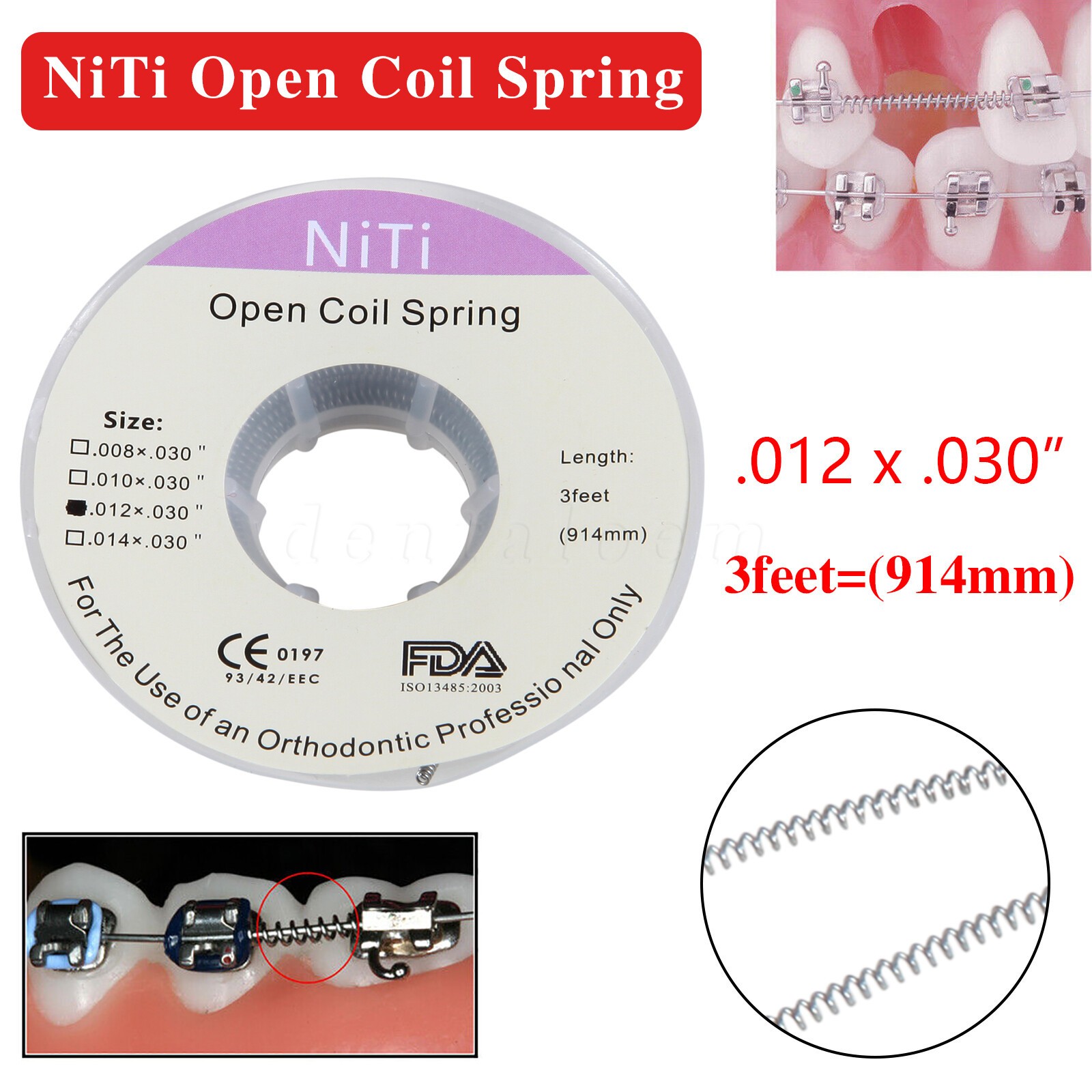 Orthodontic Dental Braces Niti Open Coil Spring Dia.012 Inch/.030 Inch 914mm OR