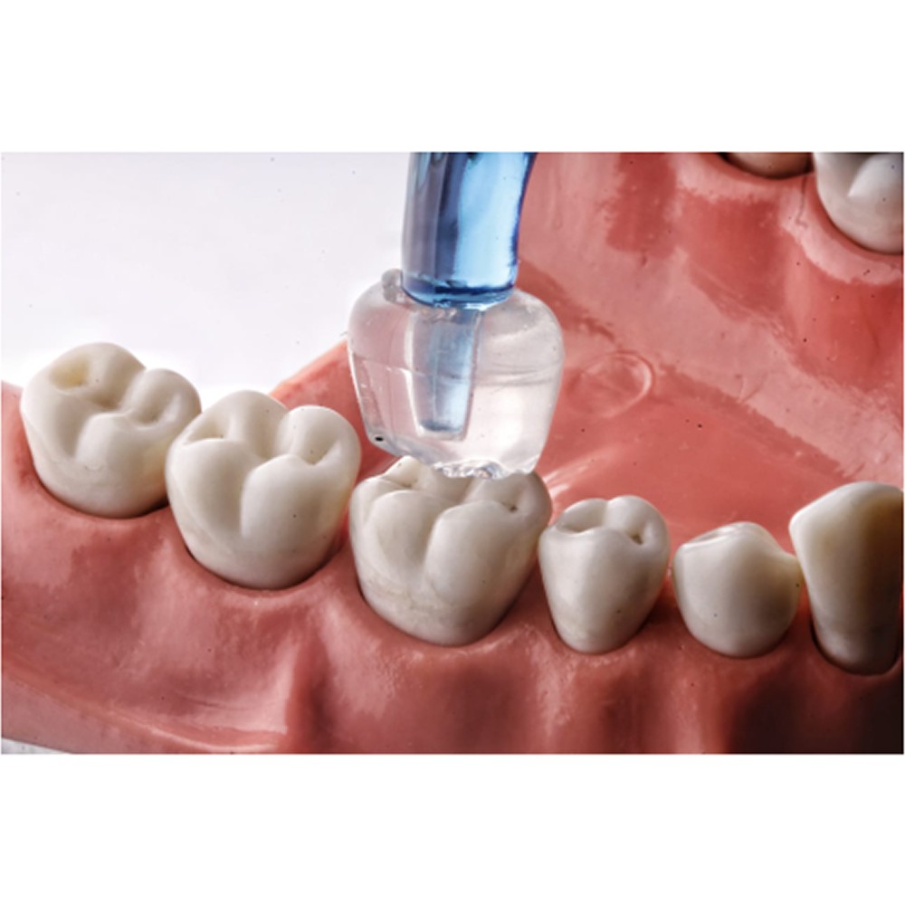 Dental Occlusal Stamp Kit | For Posterior Composite Restorations (16Pcs/Pack)