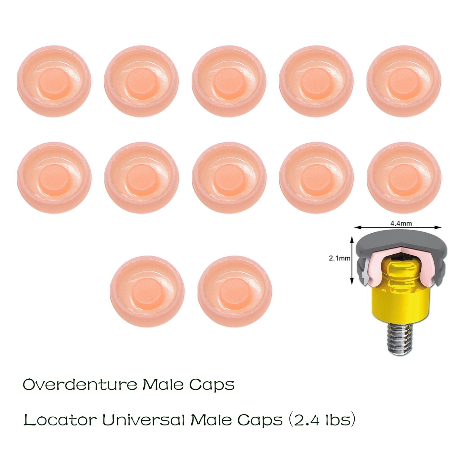 US Dental Attachment System Locator Abutment Retention Caps Replace Inserts Set