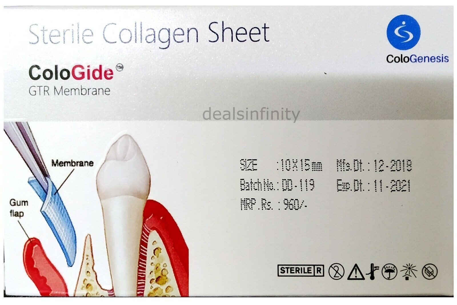 5 Pack of Cologenesis Colo Gide GTR Membrane Pack 10 x 15 mm (Free Ship)