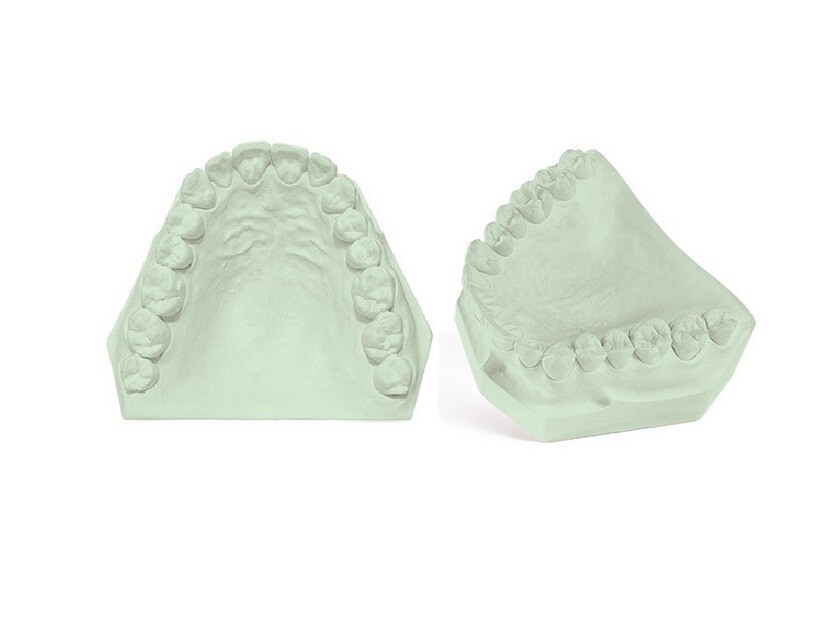 DENTAL LAB GYPSUM DIE STONE TYPE IV GREEN ALL PURPOSE STRONG COMPOUND 5 Lbs.