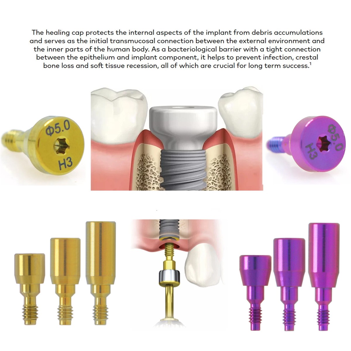 Dental RP NP Healing Abutment Compatible NobelActive Internal Conical Connection