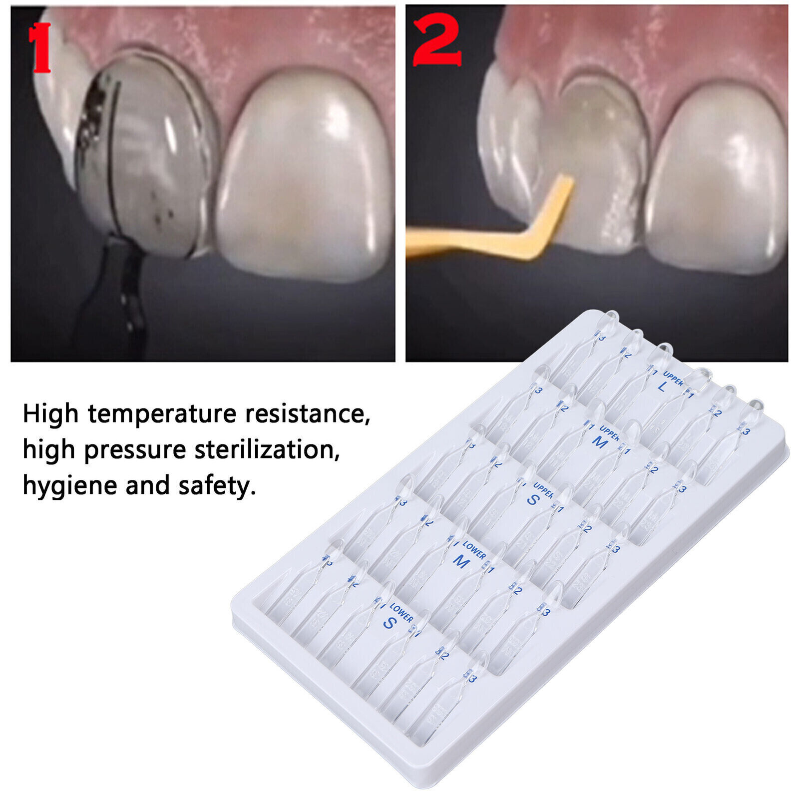 30 Pcs Composite Resin Mold Veneer Template Guide Cure Anterior Teeth Veneers