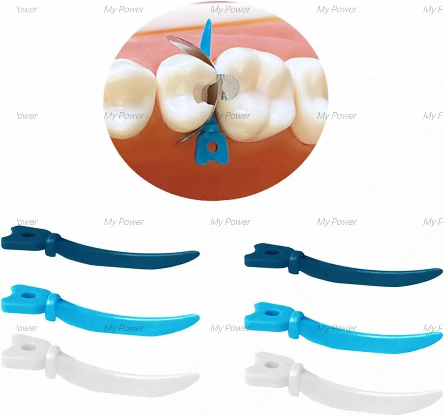 Dental Tulwar Wedges Refill Wedge For Sectional Matrix System With Hole S/M/L