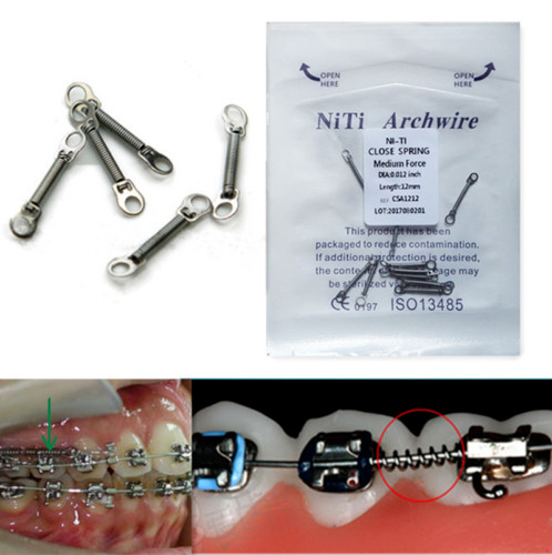 Dental Orthodontic Niti Alloy Closed Coil Spring 010 012inch 6/9/12mm 10Pcs/Pack