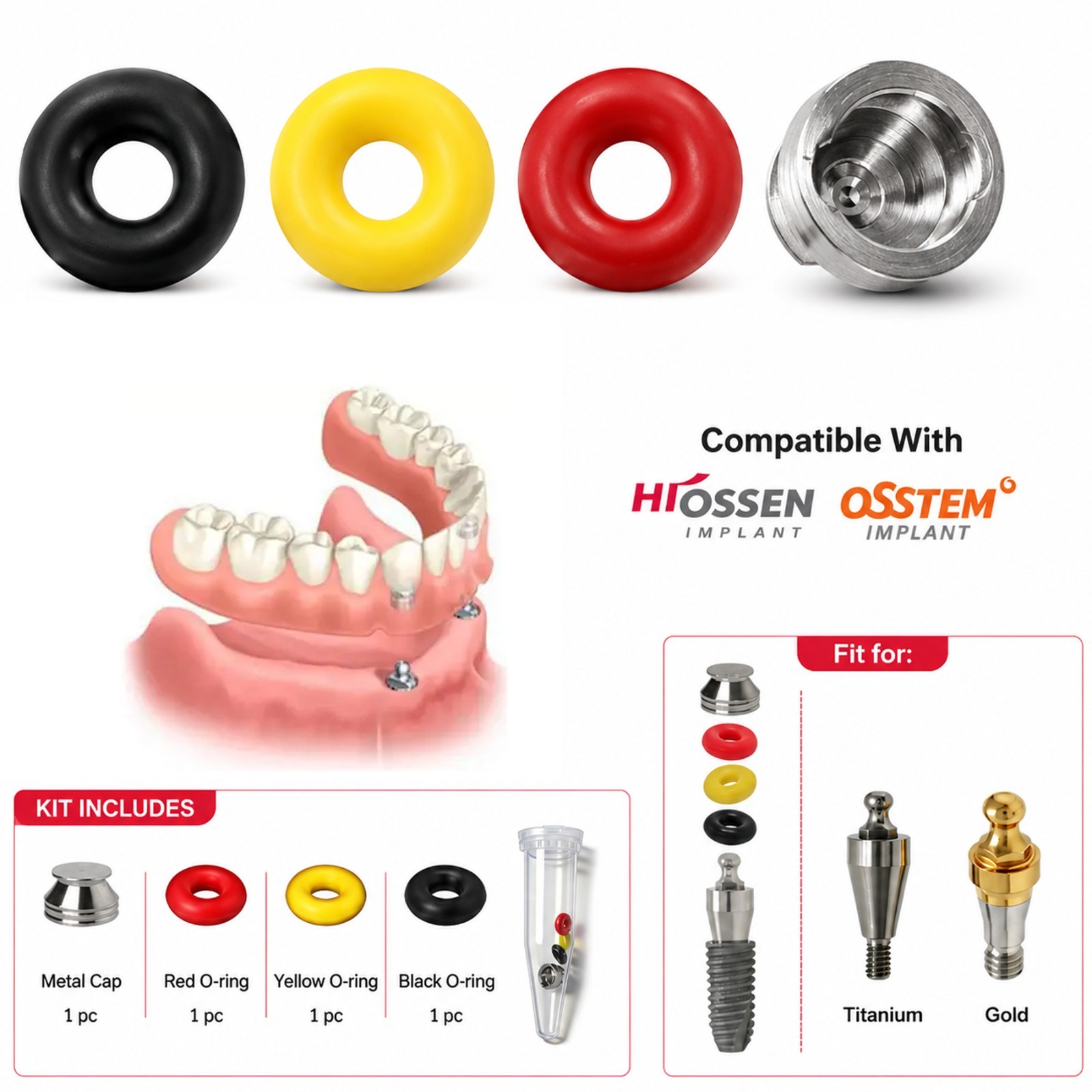 Dental O-Ring Retention Caps For Ball Attachment Abutment Hiossen/Osstem 4pc/set