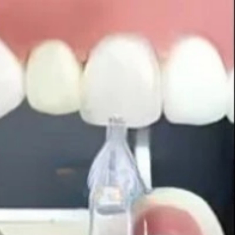 30 Pcs Dental Composite Resin Veneers Mould Light Cure Anterior Front Teeth USA
