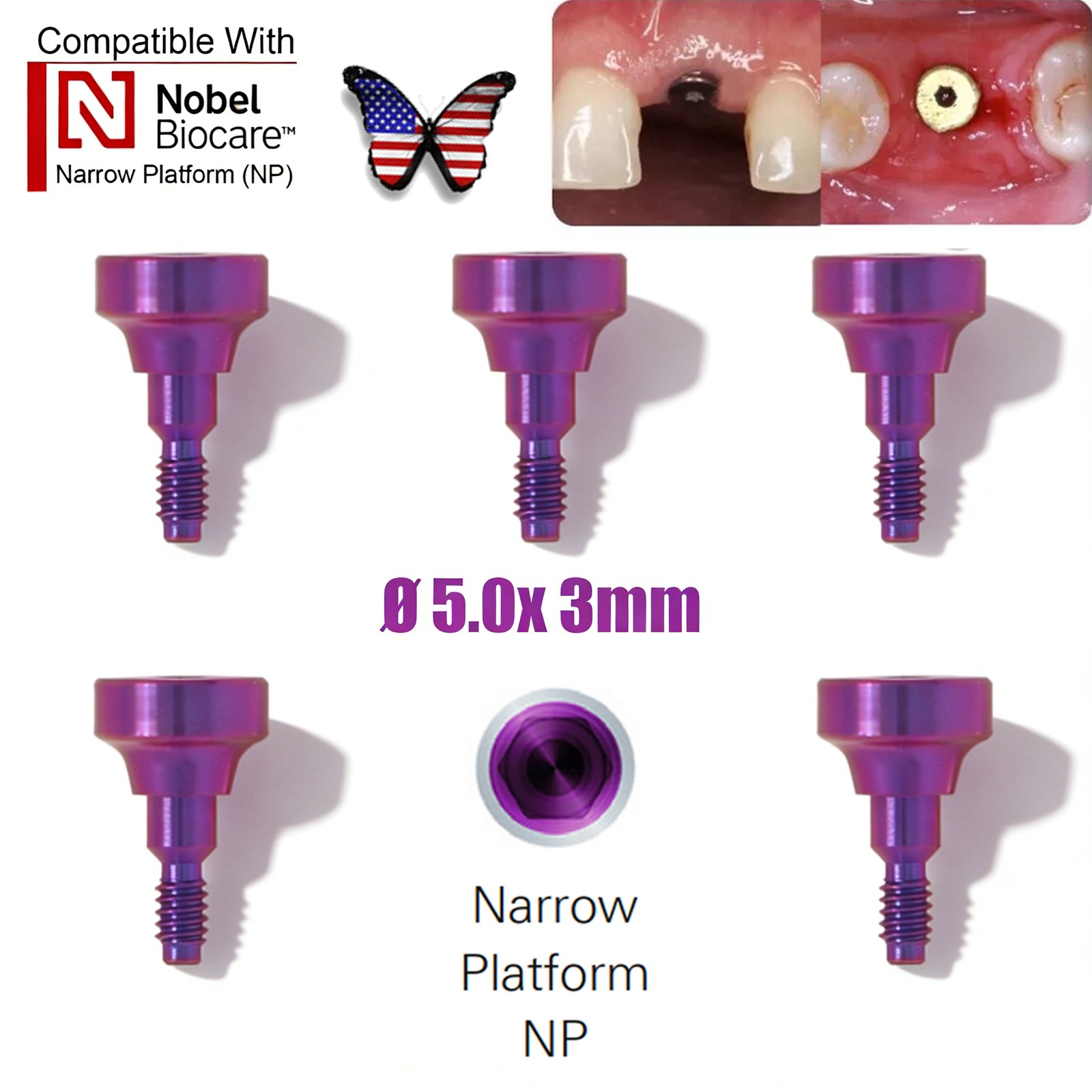 Dental RP NP Healing Abutment Compatible NobelActive Internal Conical Connection
