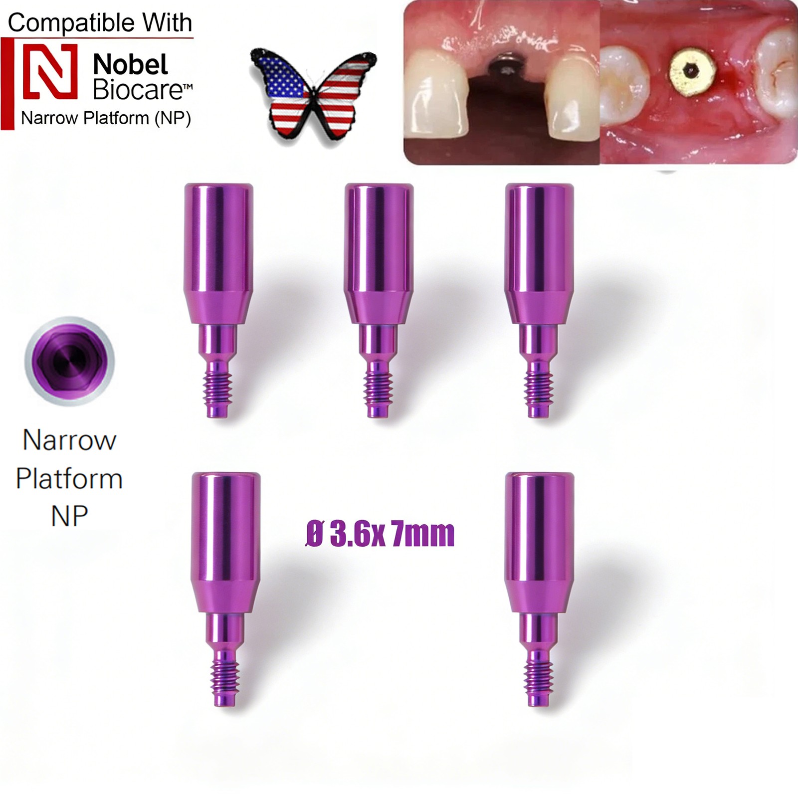 Dental RP NP Healing Abutment Compatible NobelActive Internal Conical Connection