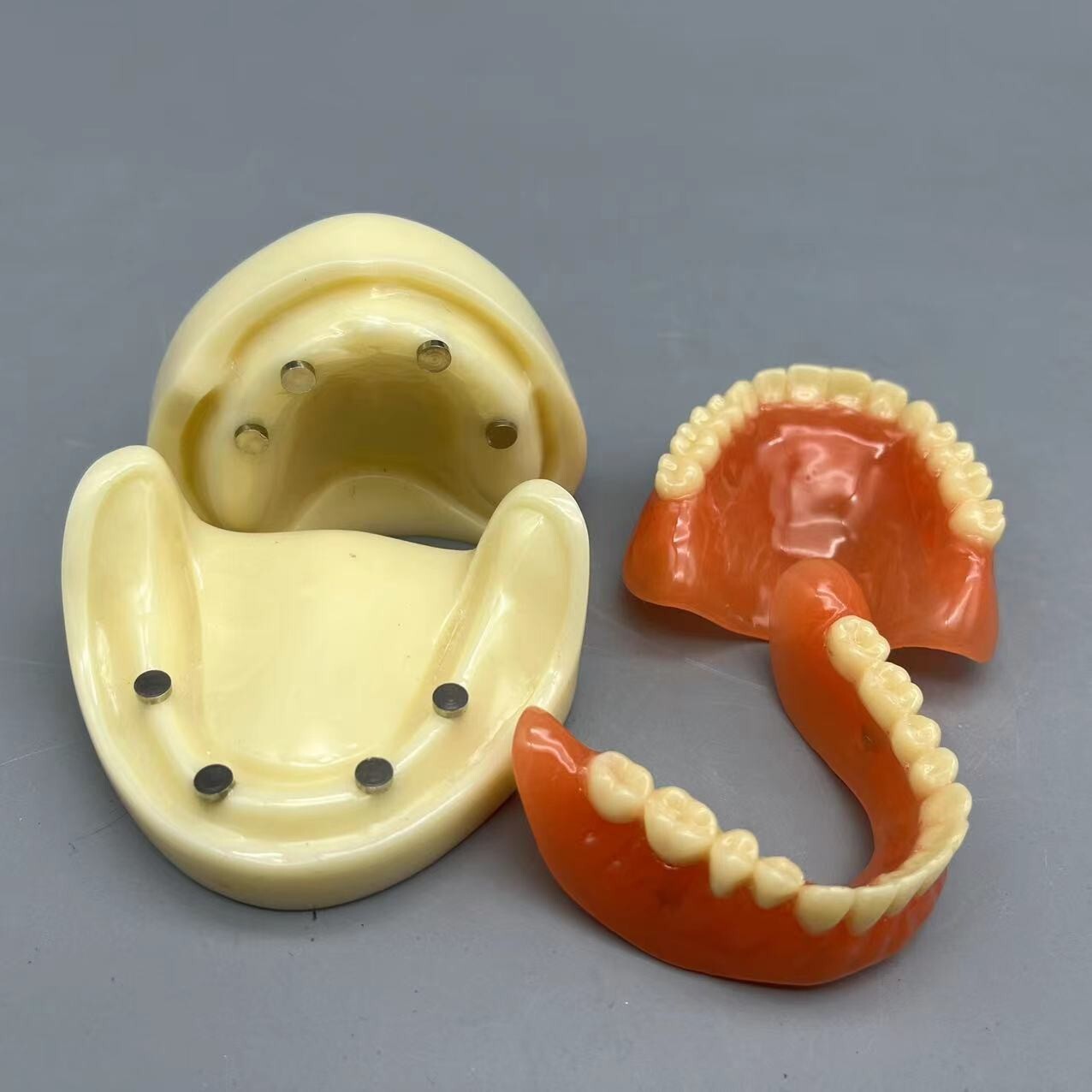 Dental 4 Implants Overdenture Typodont Restoration Upper Lower Lower Teeth Model