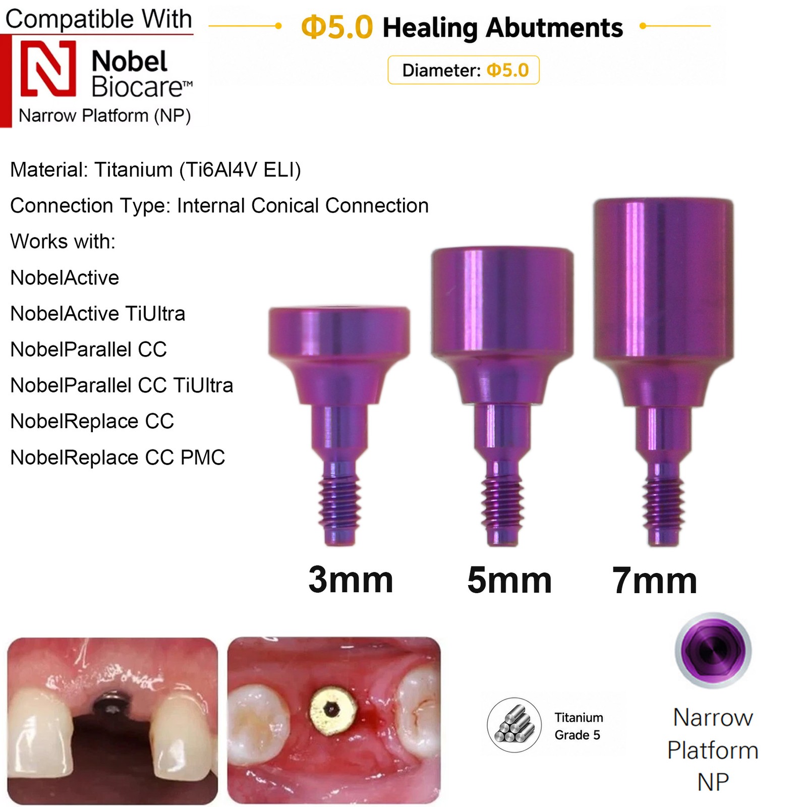 Dental RP NP Healing Abutment Compatible NobelActive Internal Conical Connection