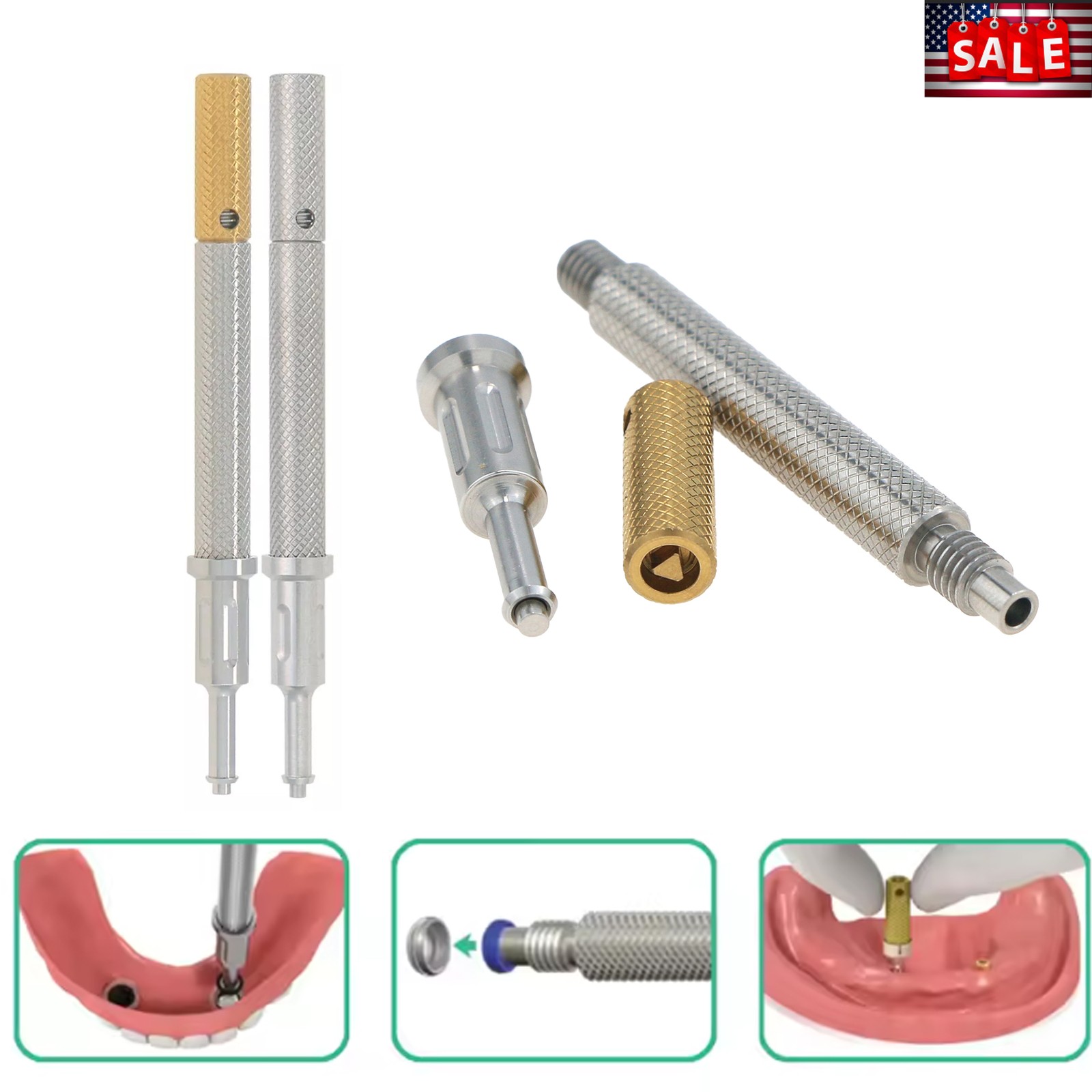 US Overdenture Removable Male Caps Inserts Standard 1.2lbs & LOCATOR Core Tool