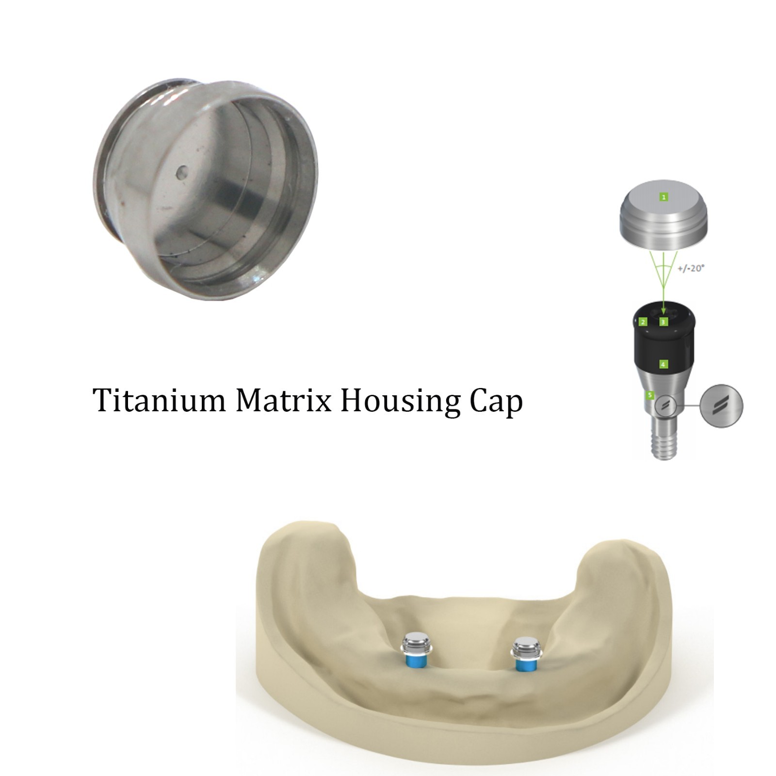 Dental Locator/Novaloc Peek Male Cap Assembly Processing Retention Insert Tool