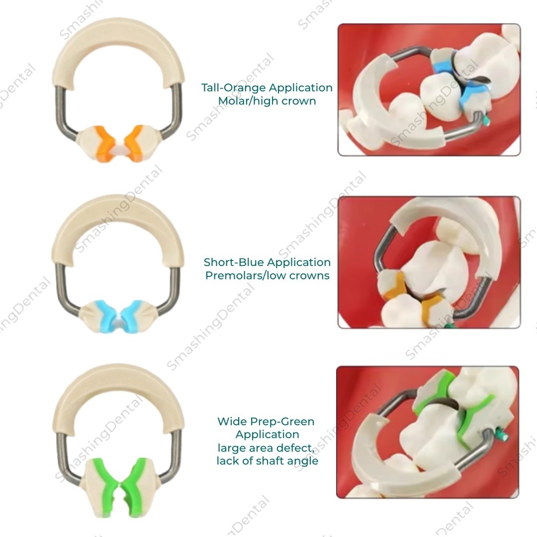Dental Autoclavable Matrix Bands Ring Matrices Clip Clamp Titanium Fit Garrison