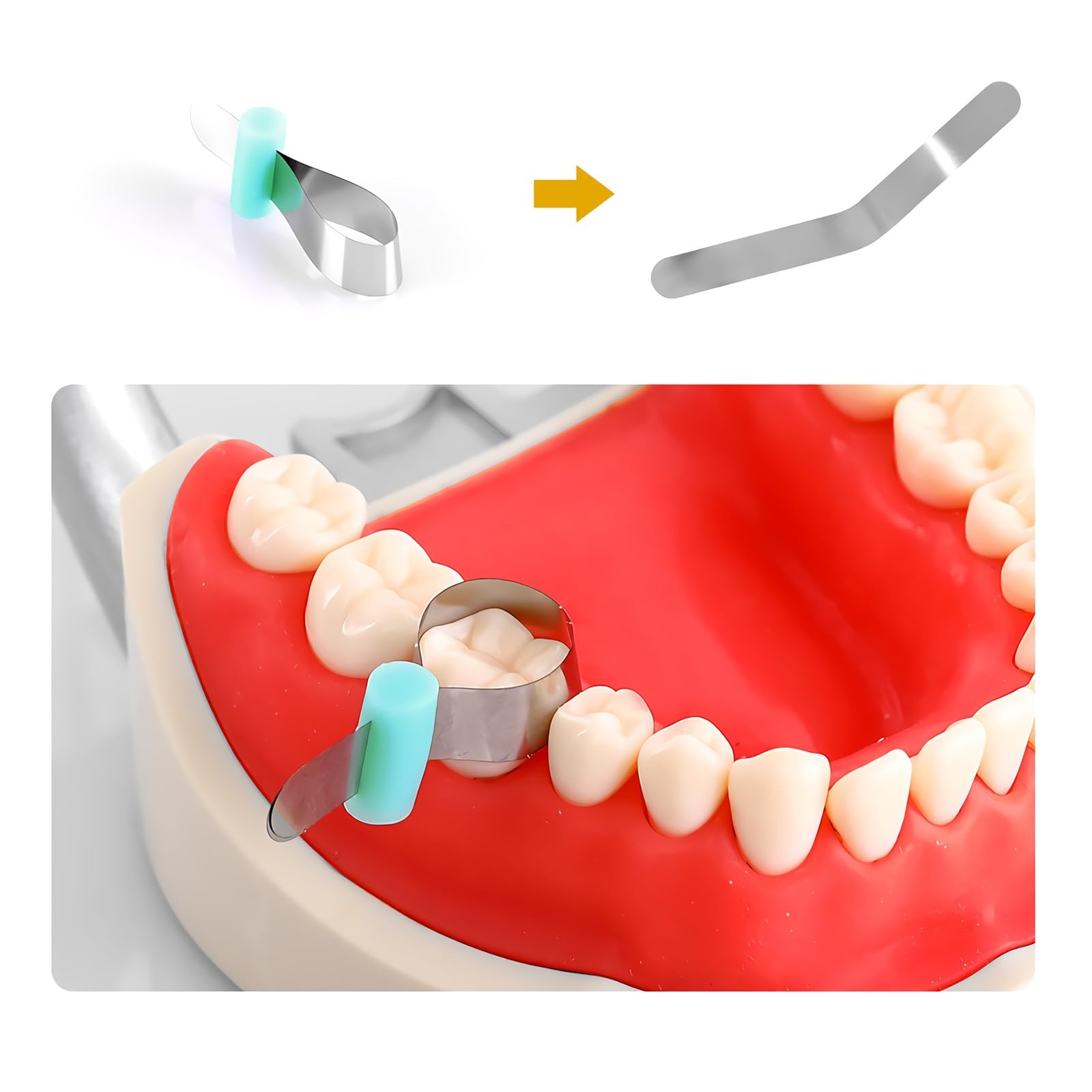 50Pcs Dental Matrix Bands, Metal Restoration Matrix…