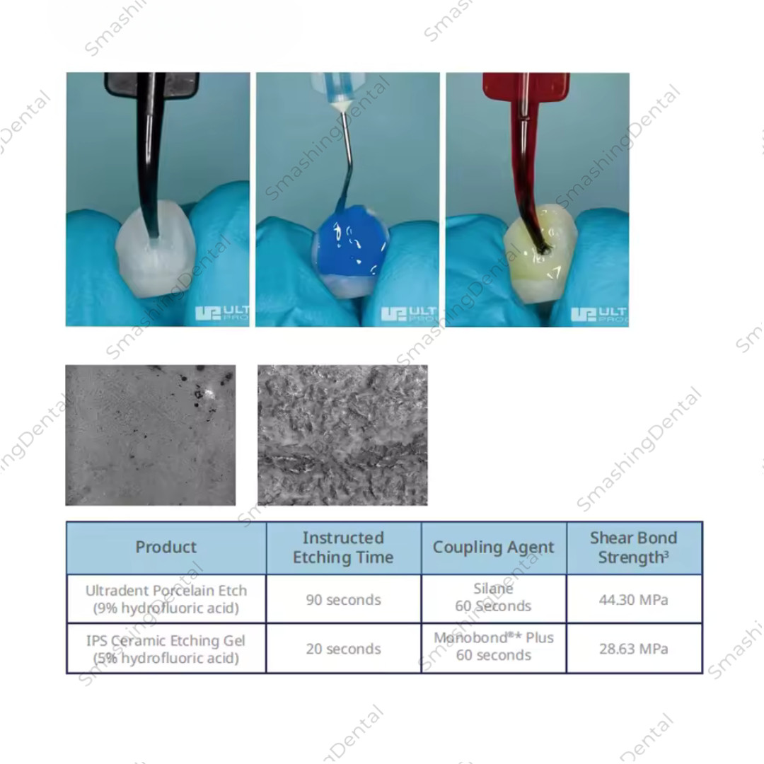 Dental Ultradent Porcelain Etch 9% Hydrofluoric Silane Dental Bond Veneer Crowns